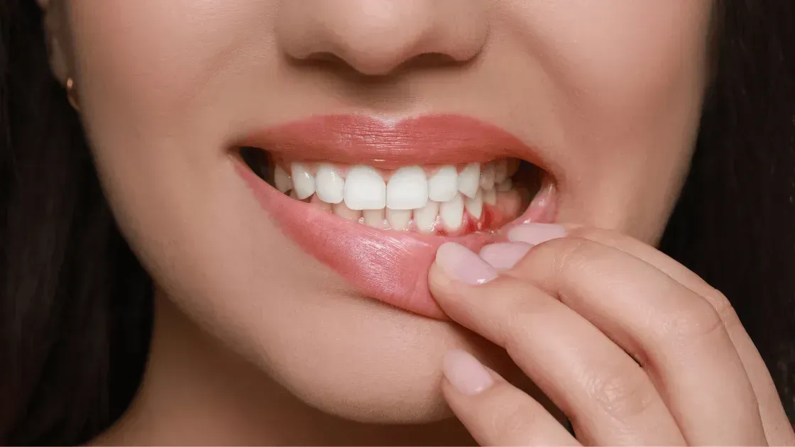 Why Do My Gums Bleed When I Brush?