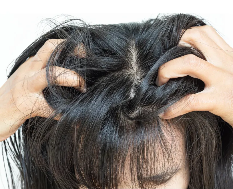 Woman examining thinning hair at the scalp, representing improved hair growth and follicle regeneration through GHK-Cu peptide therapy at Hormone Treatment Centers in Overland Park, KS.