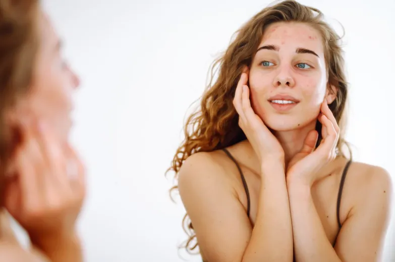 Woman looking at her reflection and touching her face with acne and redness, representing skin healing, collagen restoration, and rejuvenation through GHK-Cu peptide therapy at Hormone Treatment Centers in Overland Park, KS.