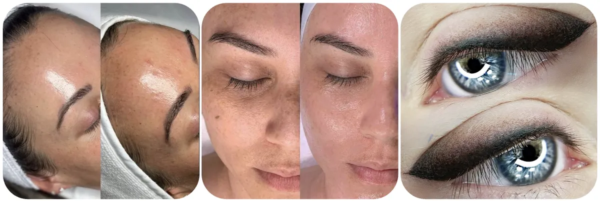 Mircoblading, Med spa, chemical peel, diamond microermabrasion, mesoneedling, meso needle, meso needling