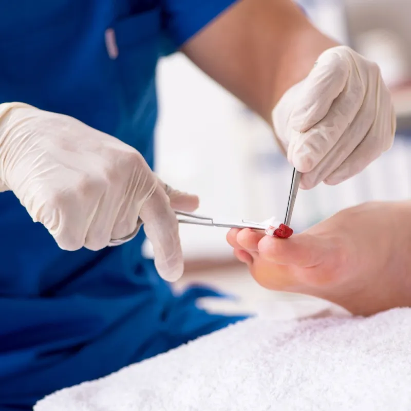 Routine Podiatry