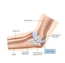 UCL & Flexor Tendon Injury Loading Protocol | Complete Progression for Pitchers