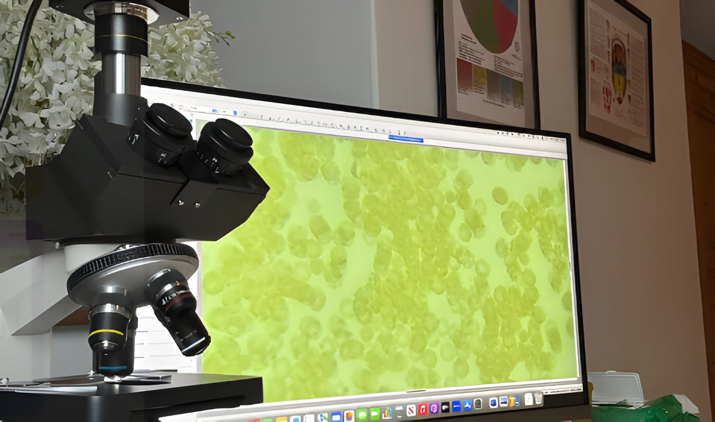 Insulin Resistance and Blood Tests Harrogate - Yorkshire