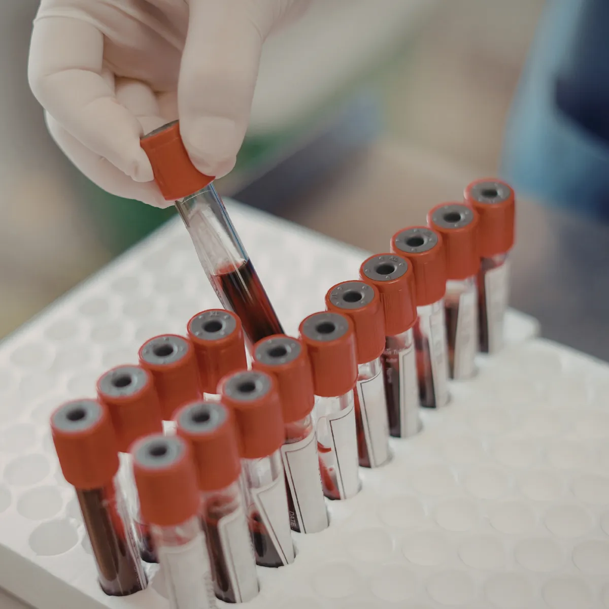 Laboratorio Clínica Mi Pueblo Las Vegas