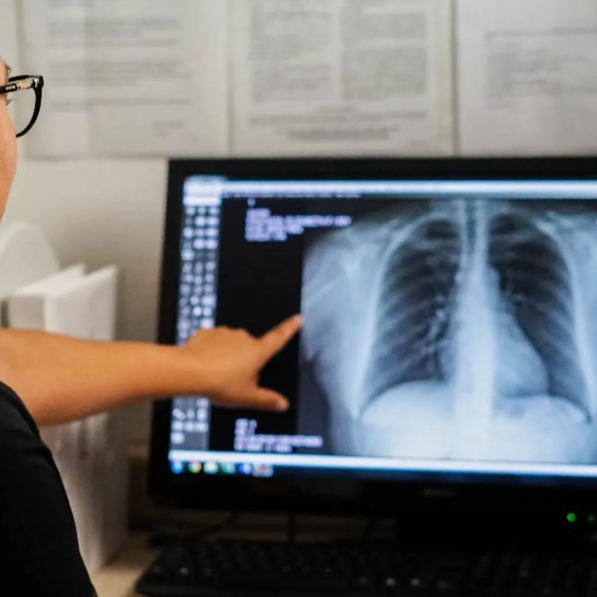 Estudios de Rayox X Clínica Mi Pueblo Las Vegas