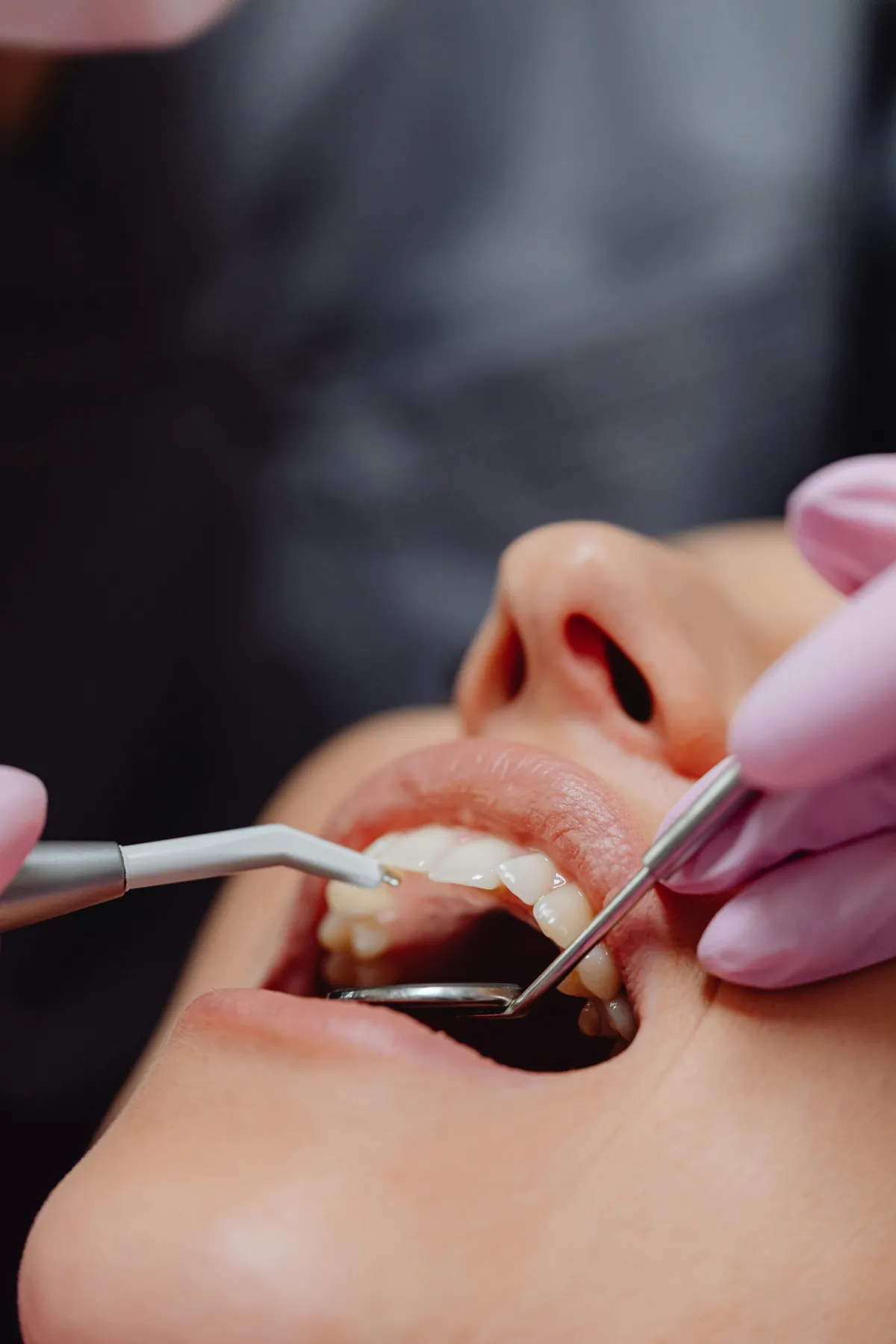 Dentist fixing teeth of a woman