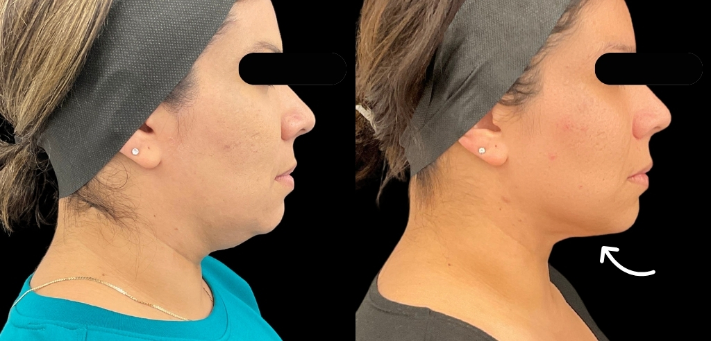 A close-up of elegant hands applying a golden serum to a woman's neck, with a plush white spa robe visible. The setting features gold accents and soft, ambient lighting, emphasizing a sense of luxury and care. The composition is intimate and refined, 3:2 aspect ratio.