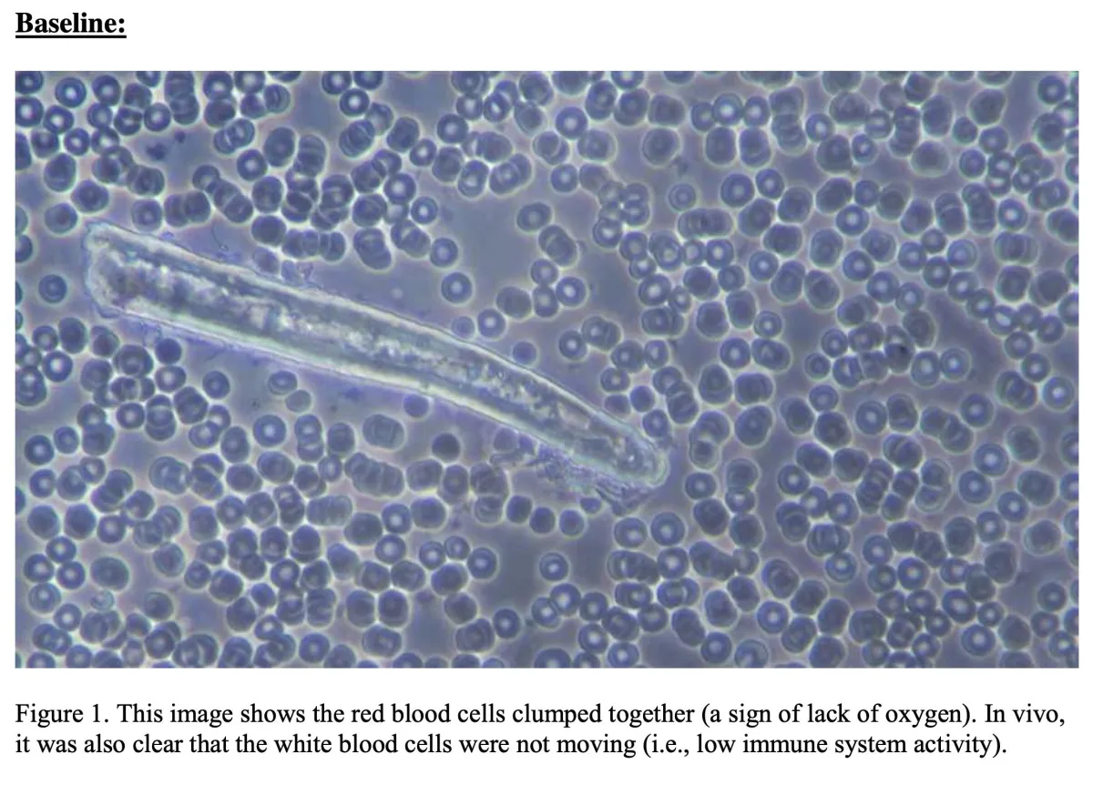 AFT Live Blood analysis before