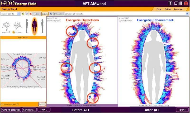 Energy balancing and vitality enhancement through AFT Quantum Wellness