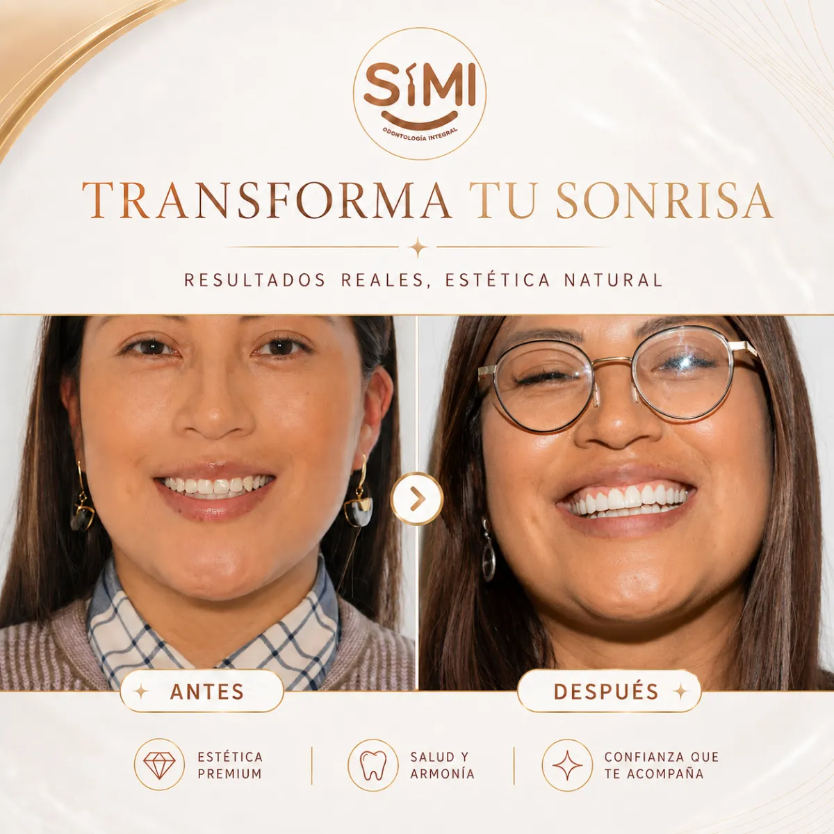 Resultado de paciente - Abdominoplastia