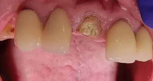 before treatment