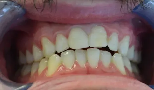 before treatment