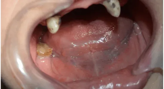 before treatment