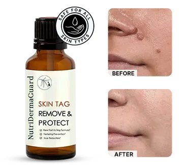 NutriDerma Guard -happy-customer