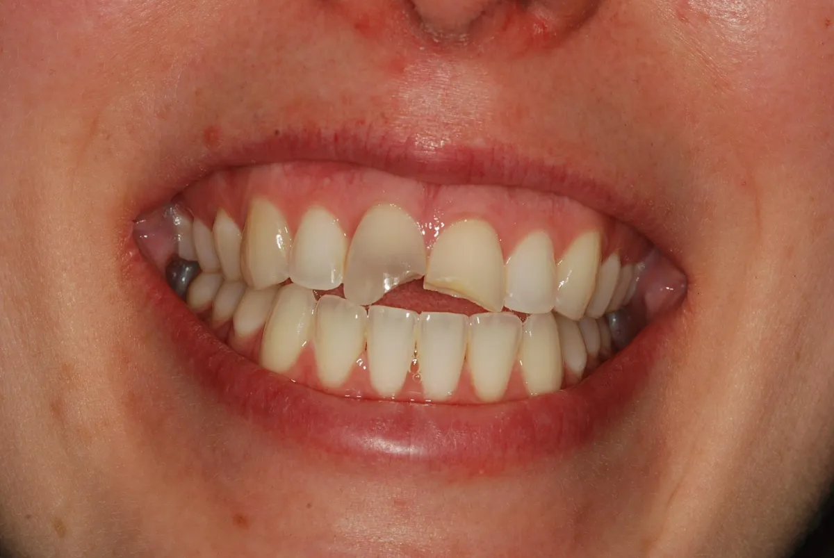 a kitchen with a sink and a lot of clutter on the counter