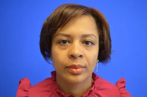 Lower Eyelid Gallery