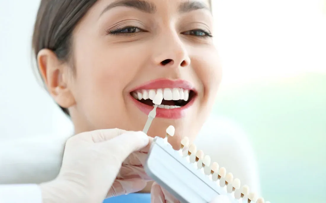 Dental Bonding