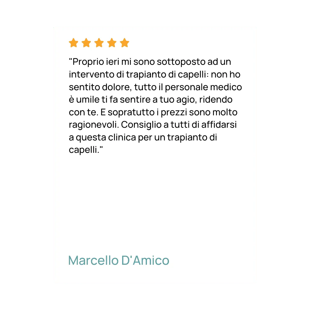 trapianto di capelli recensioni
