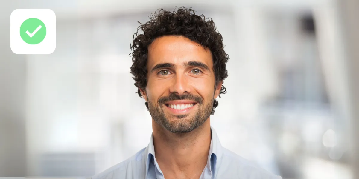 risultato trapianto di capelli