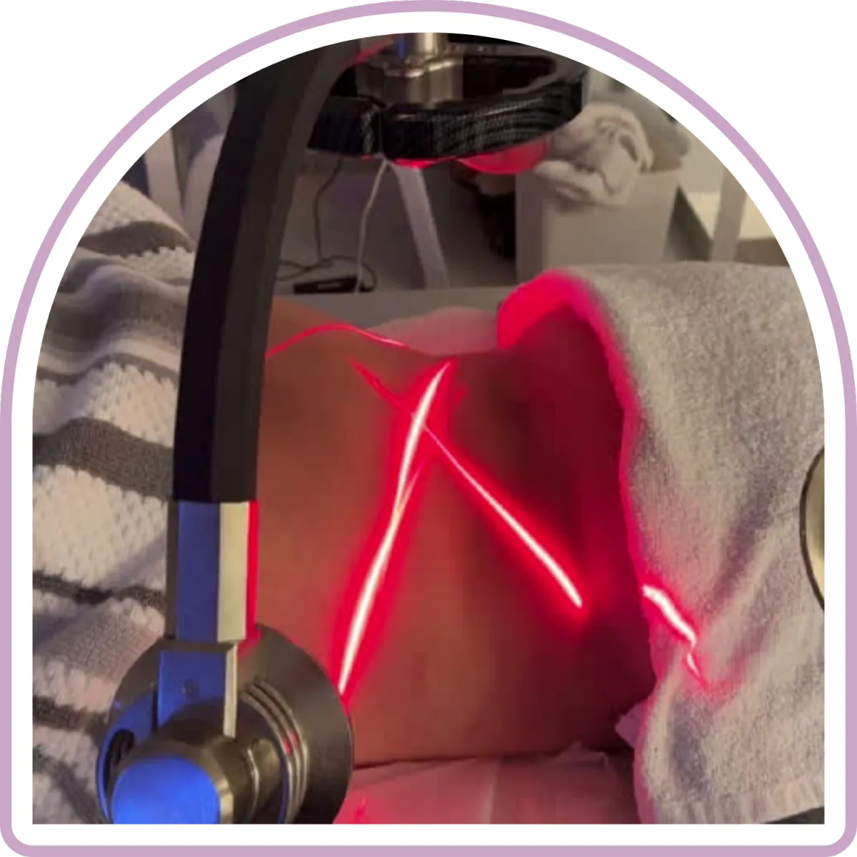 Zerona Cold Laser Treatments, Costa Mesa, California. 