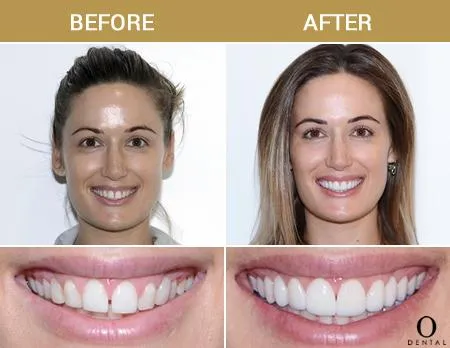 Before After Image