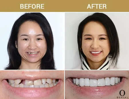 Before After Image