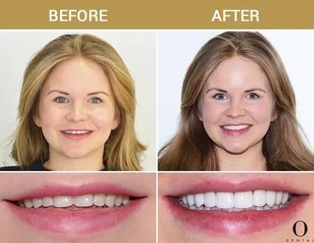 Before After Image
