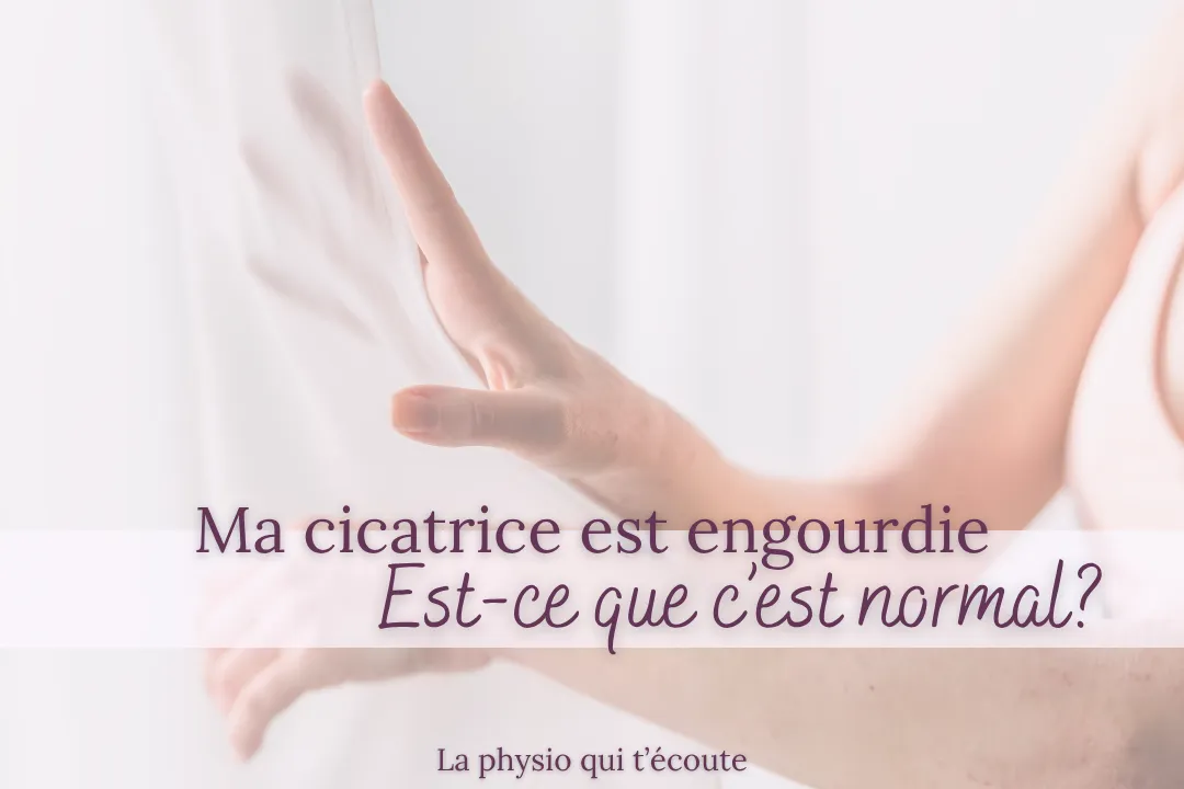 Cicatrice engourdie après une césarienne : est-ce normal?