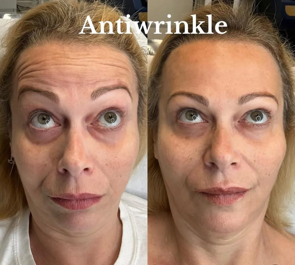 Client result before and after treatment