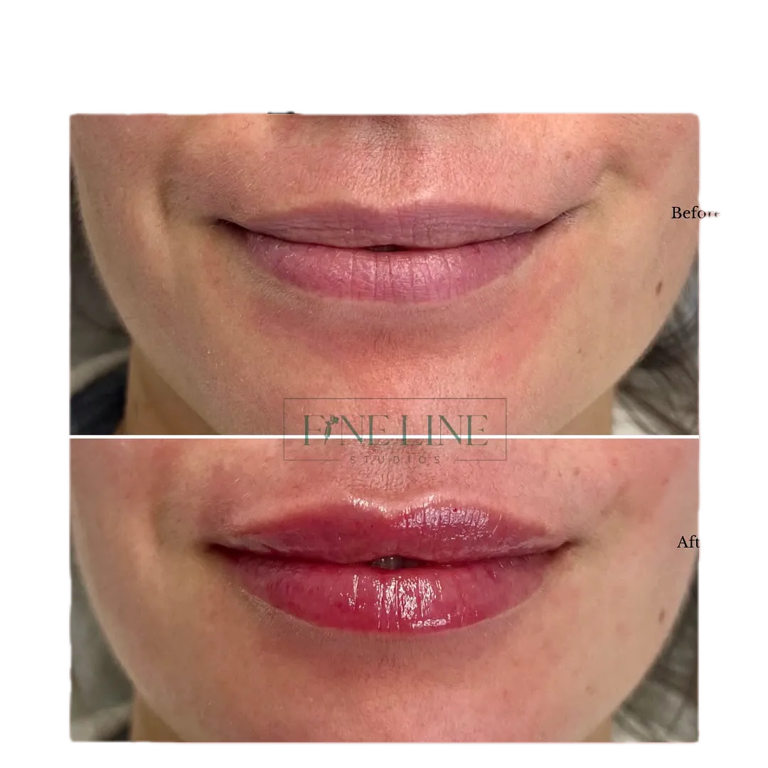 Nurse Natti treating a client at the London clinic