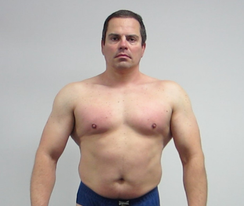 Lee Hayward Before Photo