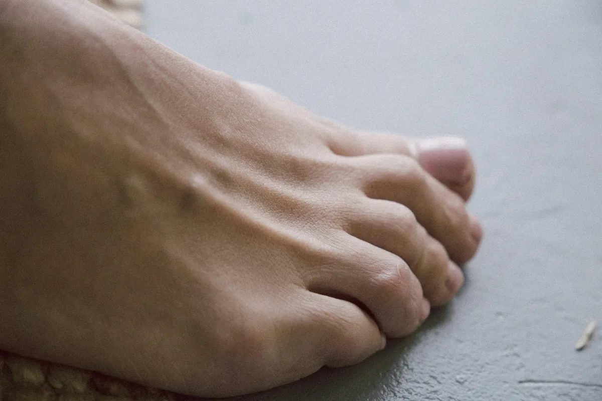 Foot Fungus Facts