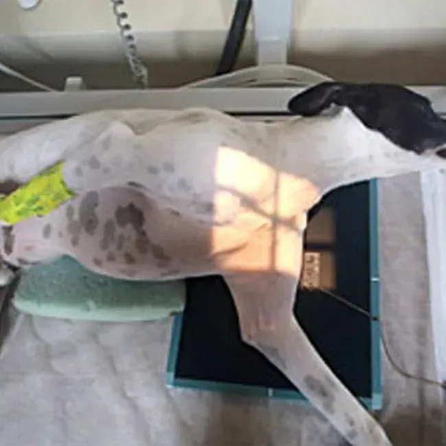 Shoulder Osteochondritis Dissecans (OCD)