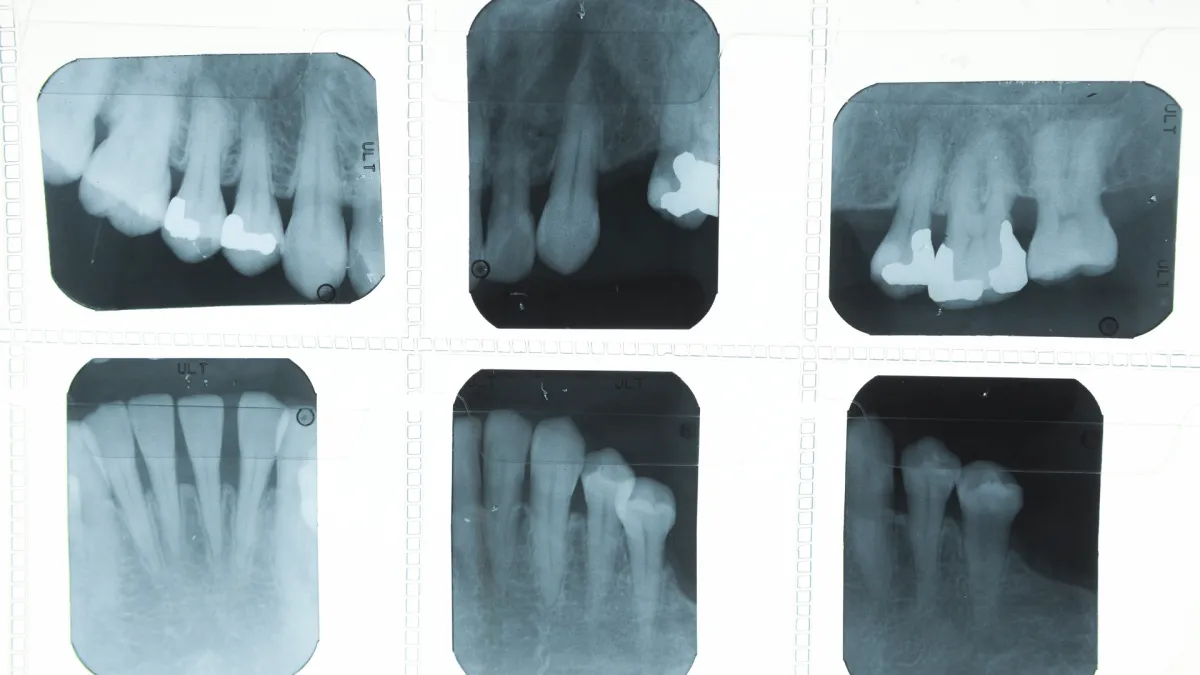 Kleinbild-Röntgen Zahnarzt
