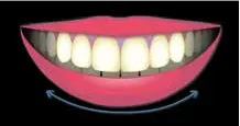 Teeth Align