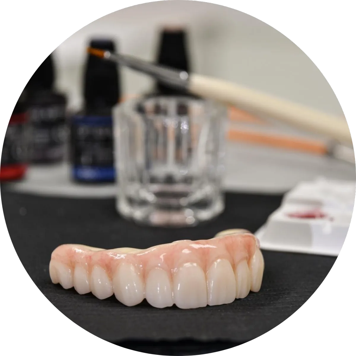 dental implant