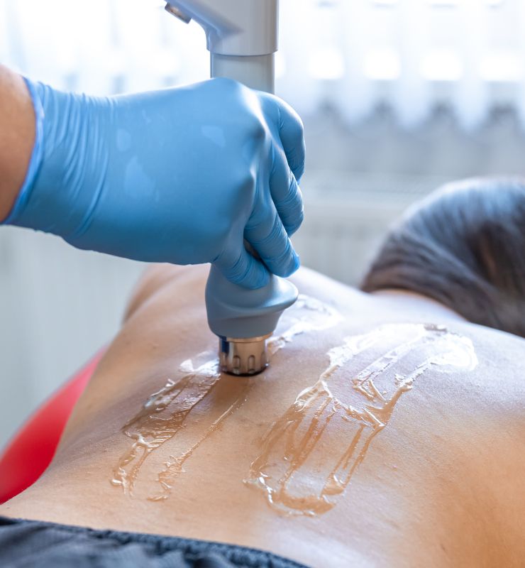 Fit Women Undergoing Shockwave Therapy Session