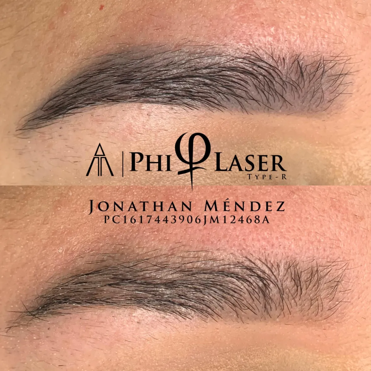 microblading powder brows cejas lashes wax curso online san juan puerto rico pestañas YY lips labios remocion laser laminado lamination remocion de tatuaje con laser