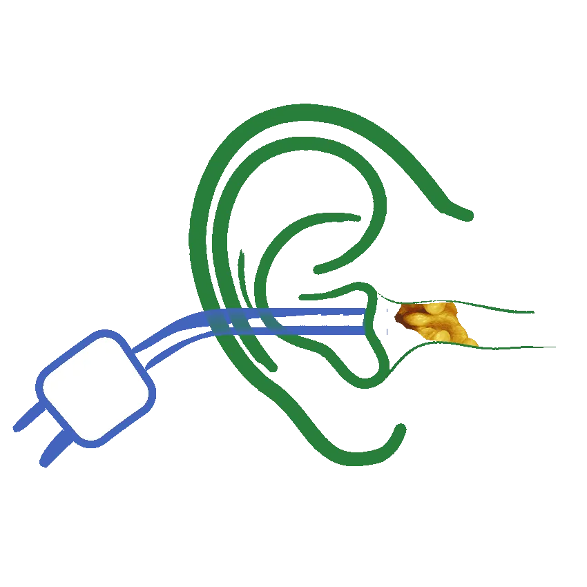 Earwax removal Melbourne