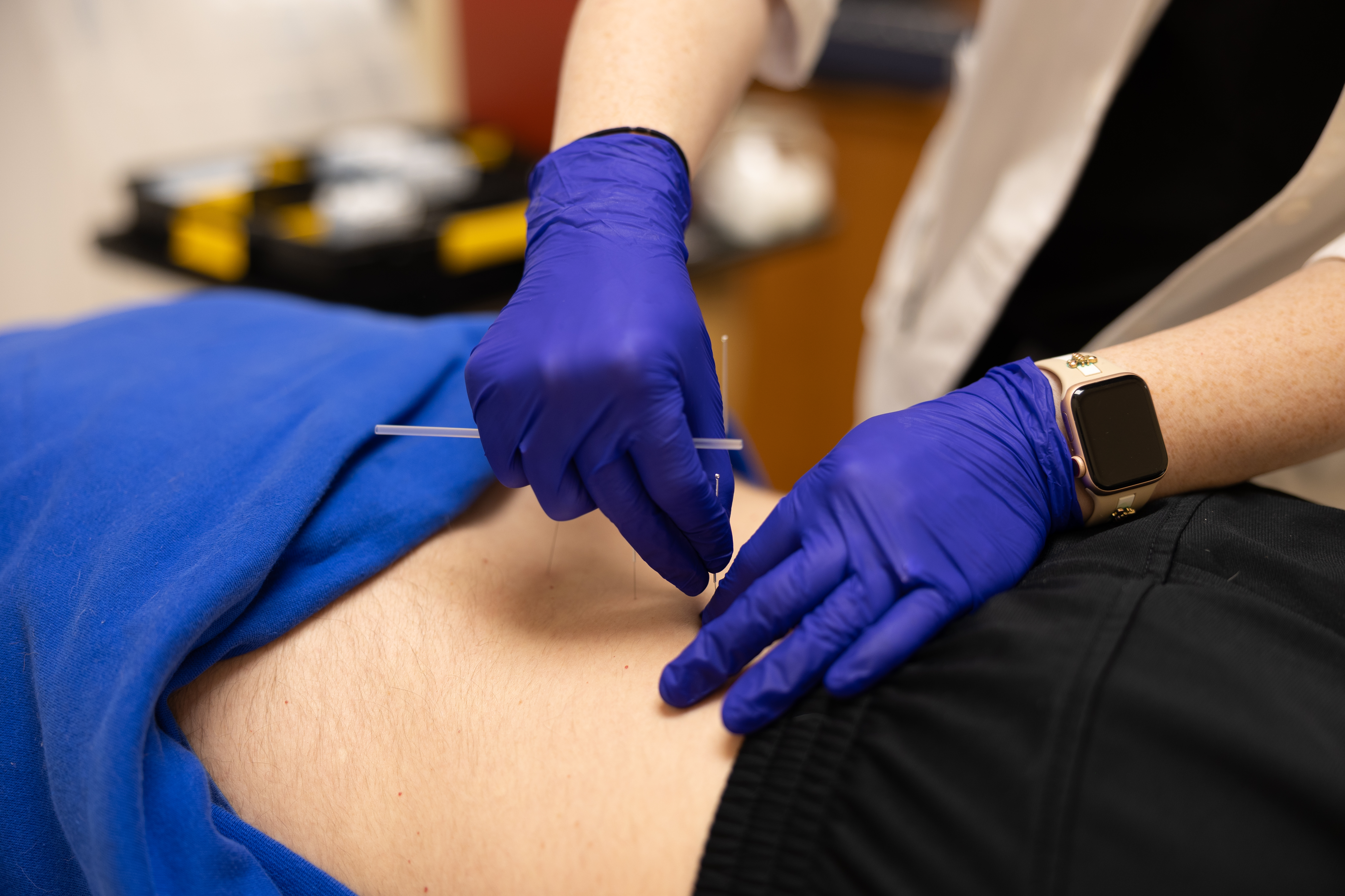 Clinician performing dry needling on a patient in a well-lit clinic