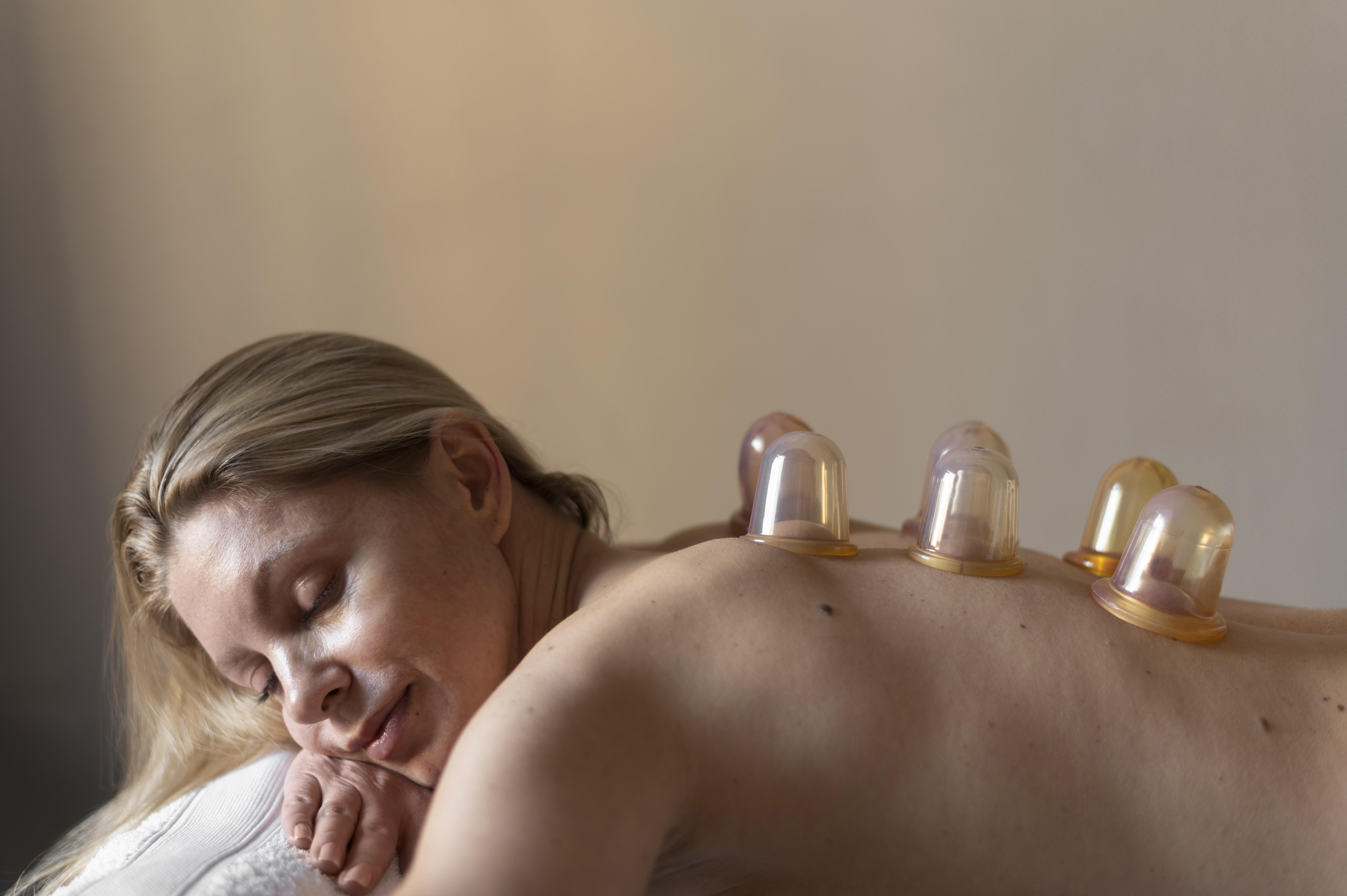 Professional cupping therapy session at Brannon Family Chiropractic