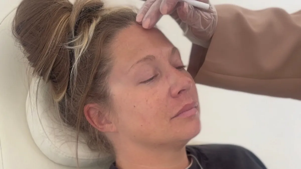 Neuromodulator Treatment Prescott AZ | Precision Mapping for Natural Results