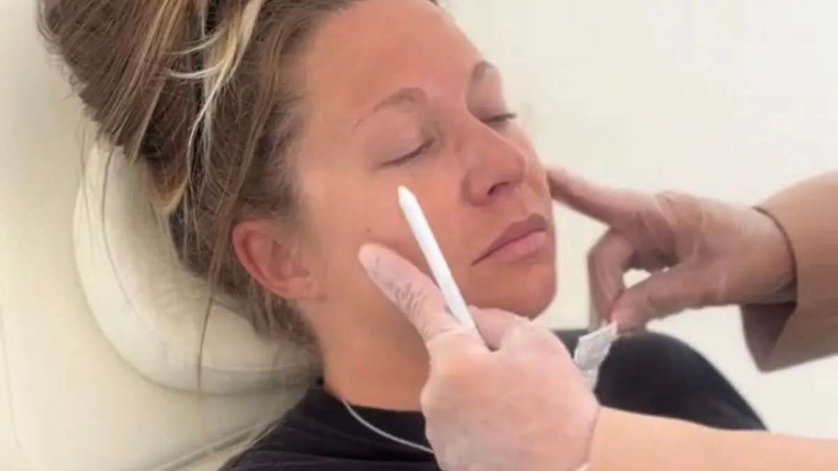 How Weight Loss Affects Your Face — When to Consider Cheek Filler | Prescott AZ