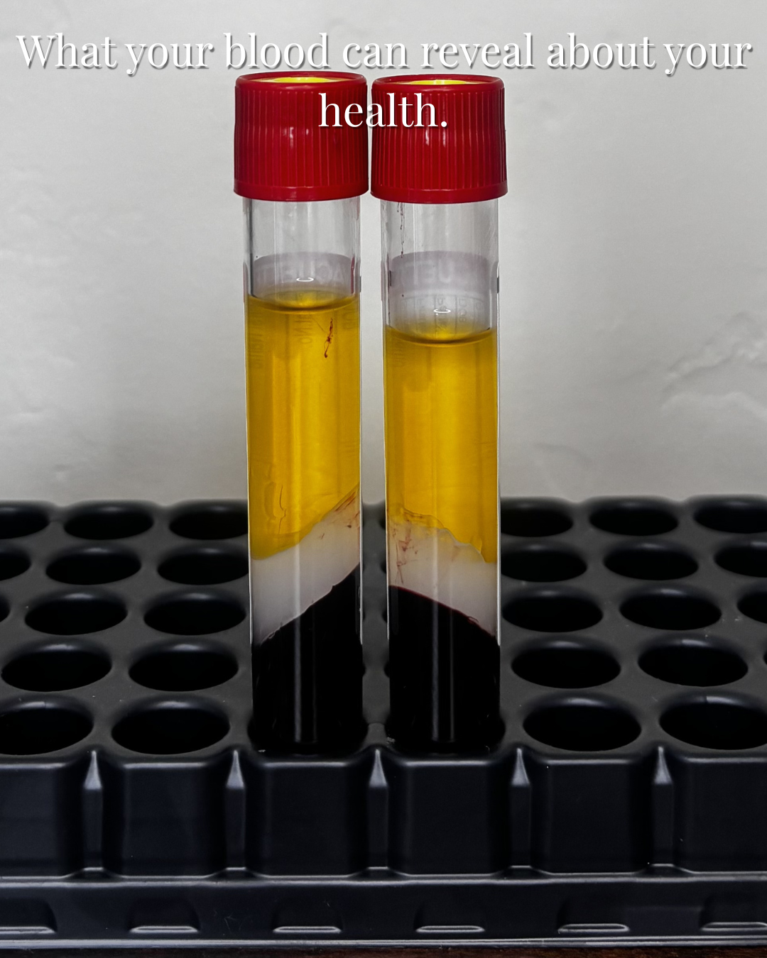 What Blood Work Can Reveal About Your Health