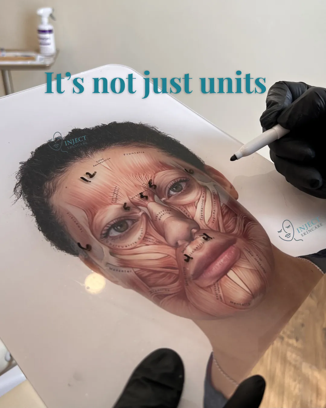Wrinkle Relaxers in Prescott, AZ: Why It’s Not Just About Units