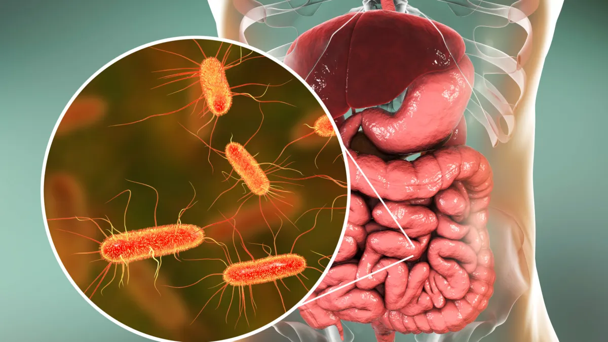 Top Signs of SIBO Most Doctors Overlook (And When to Test)