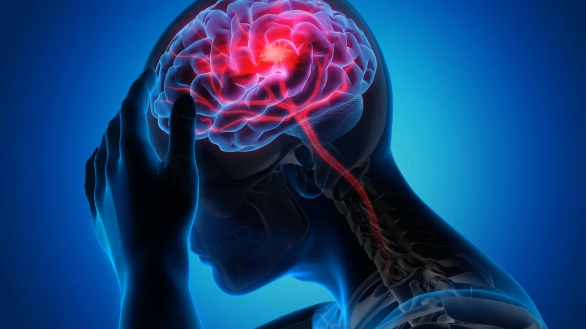 Could Mycotoxins Be Contributing to Migraines?