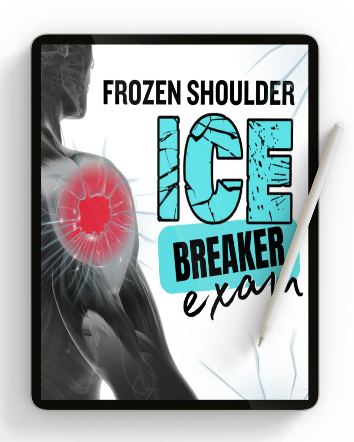 icebreaker shoulder exam Pompano Beach Chiropractic Clinic