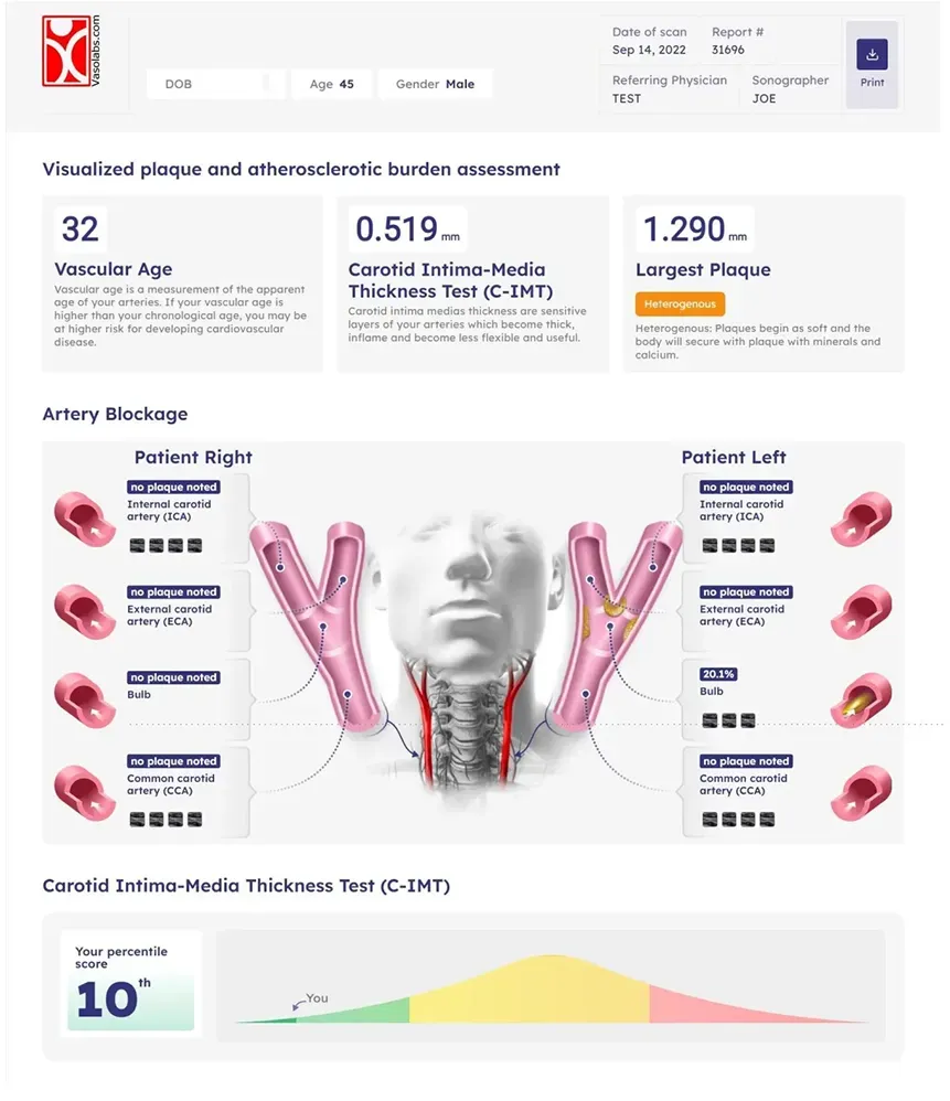 Vasolabsdata