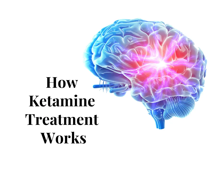 How Ketamine Treatment Works